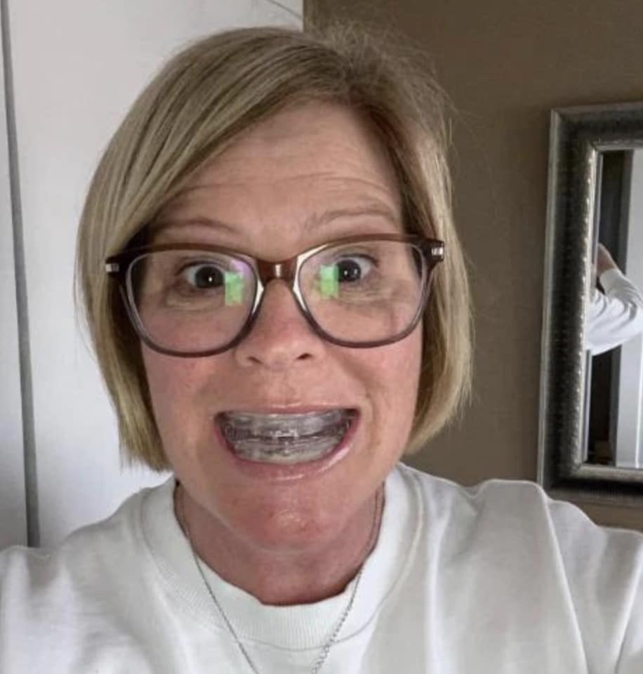 Zenouv Mouthpiece Customer