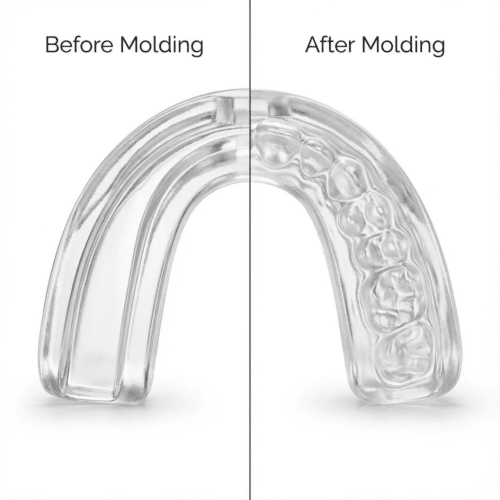 Zenouv Anti-Snoring Mouthpiece (Official Retailer) 2026